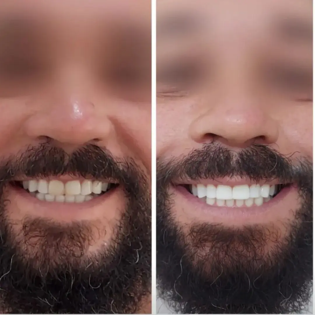 Ortodontia — registro depois do tratamento